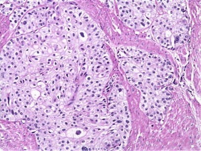 Cancer Histology AI - Owkin product screenshot